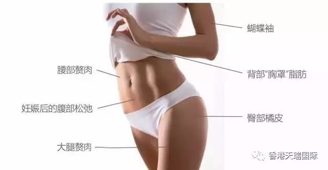 現(xiàn)下流行的BTL脂肪刀，有什么效果？