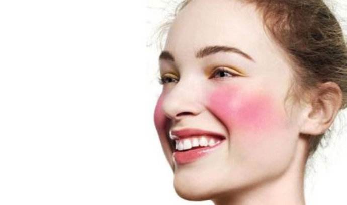 為什么錯誤護(hù)膚會導(dǎo)致紅血絲？