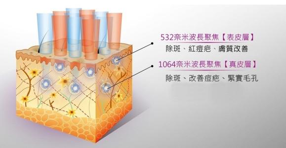 祛痘我用點(diǎn)陣，你呢？！