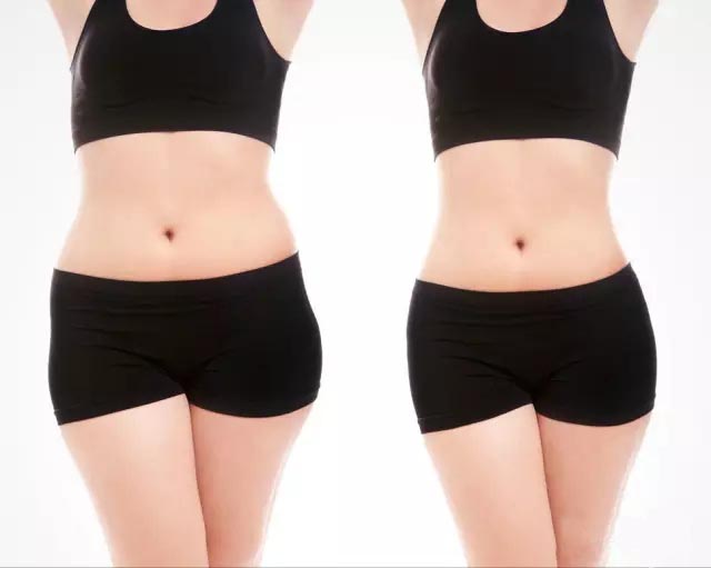 UltraShape優(yōu)立塑非侵入式專利科技、有效、安全！